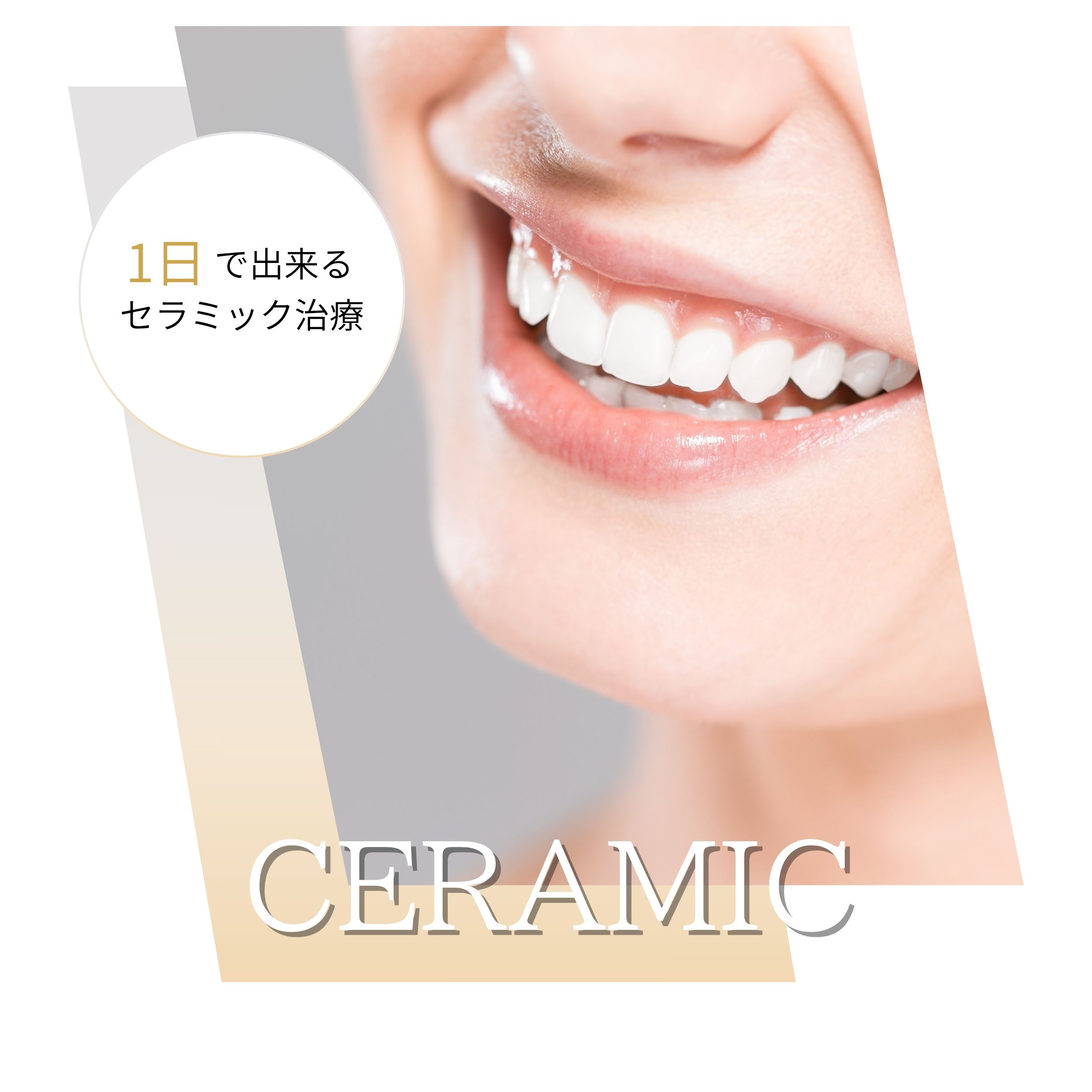 セラミック治療・補綴治療