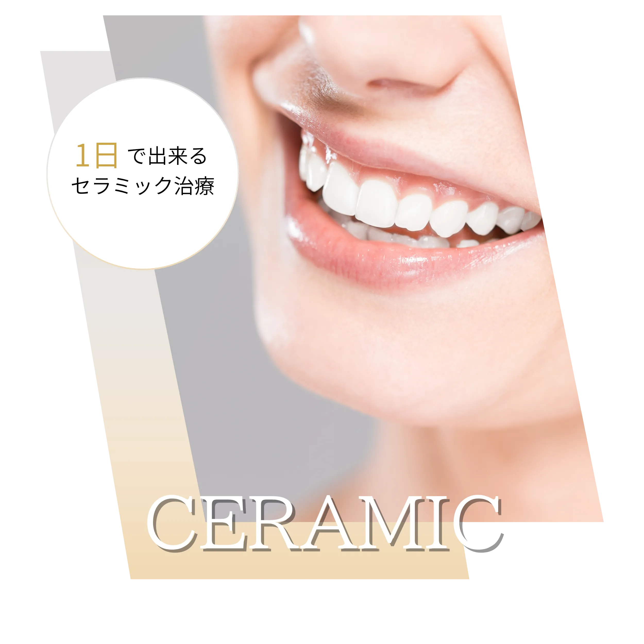 セラミック治療・補綴治療